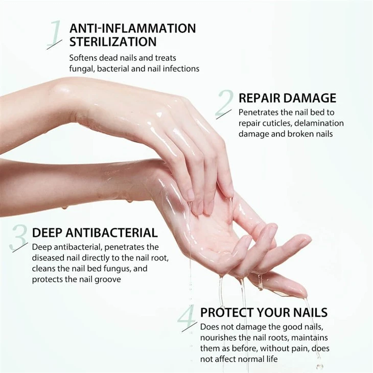 7 Days Nail Fungus Treatment Serum high quality